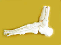 オーダーインソール 骨の変形・巻き爪・腰痛・膝の痛み